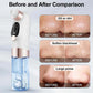 Blackhead Suction Vacuum Pore Cleaner